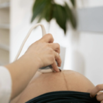 Les étapes du suivi médical durant la grossesse